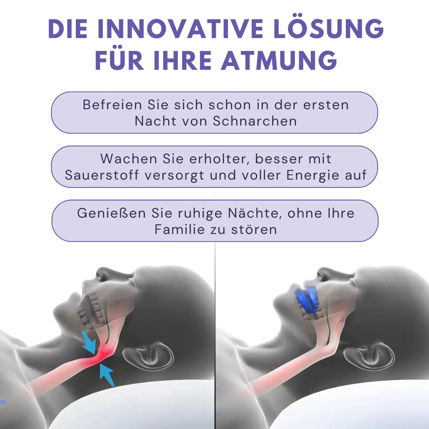 Silent Snore™ | Anti-Schnarch-Lösung
